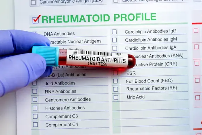 Rheumatoid Factor Tests for Arthritis Diagnosis